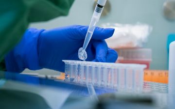 Ученые объяснили ошибочные результаты тестов на коронавирус