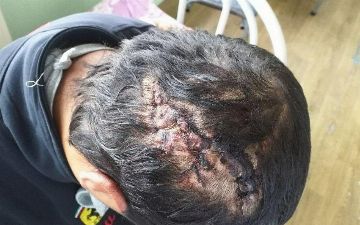 В Андижане 10 человек жестоко избили мужчину: сотрудники УВД игнорируют данный инцидент