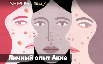 «Самая большая ошибка в лечении акне – самолечение»: личный опыт узбекистанок