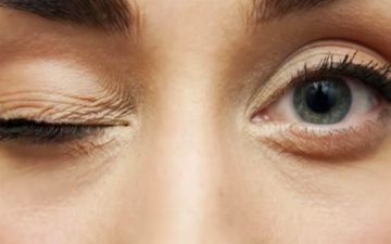 Узбекский терапевт рассказала, что такое миокимия, или почему дергается глаз