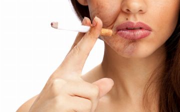 Дерматолог назвал способы избавиться от морщин курильщика