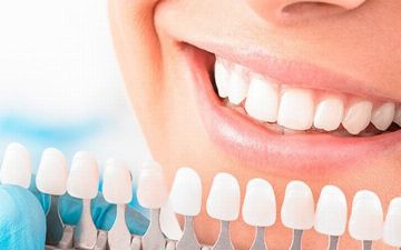 Узбекский стоматолог рассказал о преимуществах зубных имплантов