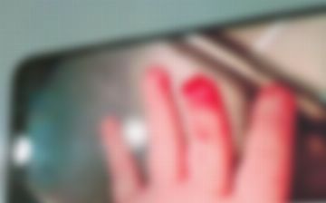 В Ургенче из-за невнимательности сотрудников детсада двухлетний ребенок серьезно повредил палец