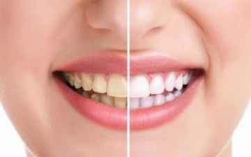 В Минздраве рассказали, почему зубы меняются с возрастом