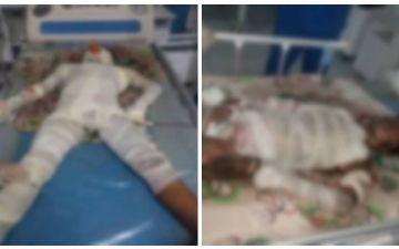 В Андижане мальчик залез на крышу вагона и попал в реанимацию: его ударило током