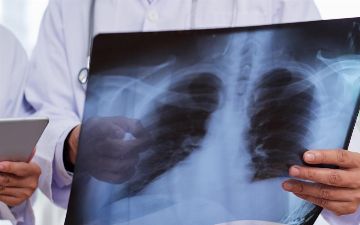 За вчерашний день в Узбекистане менее, чем у 400 человек выявили пневмонию