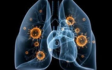 Три характерных симптома пневмонии, которые можно легко распознать