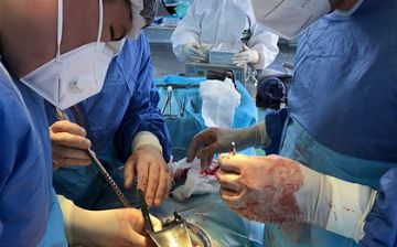 Врачи в России случайно обнаружили у пациентки 30-сантиметровый тромб
