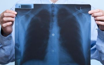 В Узбекистане от пневмонии умер еще один пациент — статистика