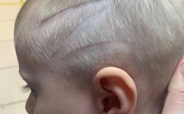 В России у ребенка без разрешения выбрили на голове букву Z – символ российского вторжения в Украину