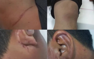 Житель Хорезма заявил об избиении и пытках сотрудниками ОВД