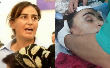 В Сурхандарье избили директора школы. Месяц назад она публично спорила с хокимом области (видео)