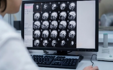 ИИ научили выявлять болезнь Паркинсона за семь лет до появления первых симптомов
