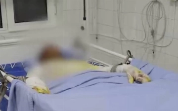 В Ташобласти подросток получил удар током, пытаясь сделать селфи на вагоне