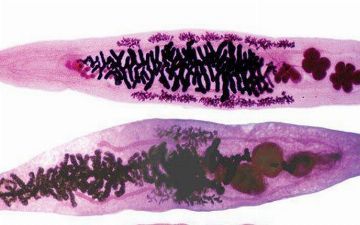 Ученые начнут заживлять раны при помощи червей-паразитов