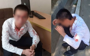 Учителя одной из школ Ташкента избили до крови