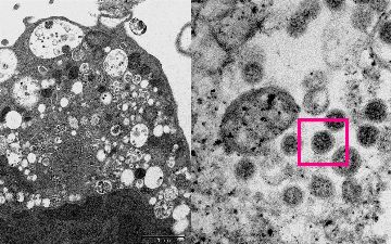 Ученые рассказали, почему омикрон-штамм коронавируса протекает не так тяжело, как другие мутации