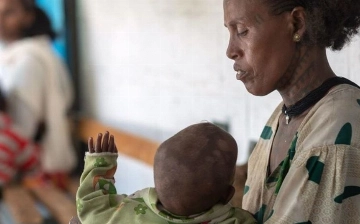 ВОЗ: Около 45 млн детей по всему миру страдают от истощения