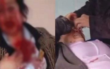 В Самарканде сотрудницы больницы устроили кровавую драку (видео 18+)