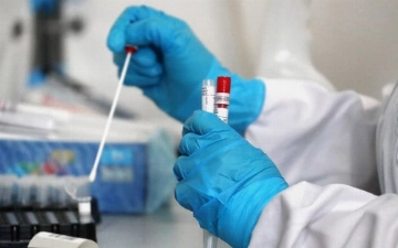 В воскресенье коронавирус подхватили более 150 узбекистанцев