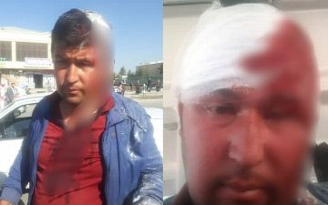 В Шахрисабзе хулиганы жестоко избили 33-летнего гражданина на глазах у его родителей