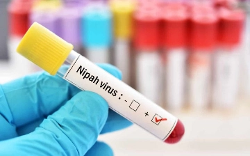 Специалисты рассказали, грозит ли Узбекистану выявленный в Индии вирус Нипах