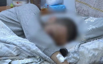 Молодой житель Ташкента лишился кисти из-за взрыва пиротехники