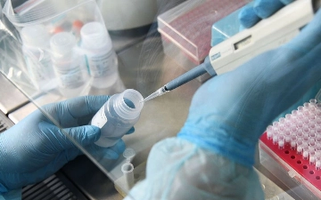 В Китае и Монголии выявили бубонную чуму: угрожает ли она Узбекистану