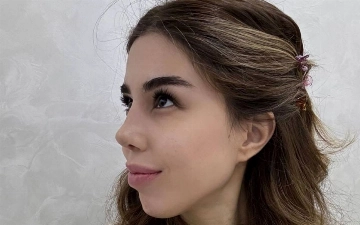 Блогер Диера Азимова похвасталась результатом после операции носа