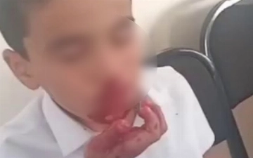 Qashqadaryodagi maktabda oʻqituvchi oʻquvchini urdi