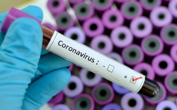 Заразный, но не опасный: что известно о новом штамме коронавируса FLiRT