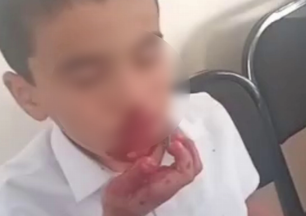 Кадр из видео