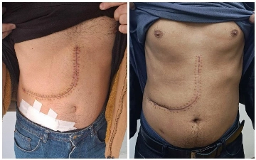 Inson organlari savdosi bilan shug‘ullangan shaxslar qo‘lga olindi