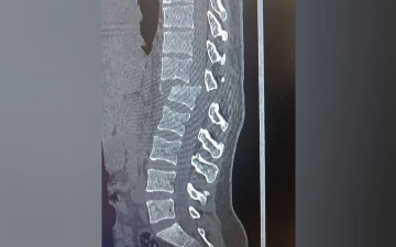 Жителю Навои, сбившему на машине жену, переквалифицировали статью на более тяжкую