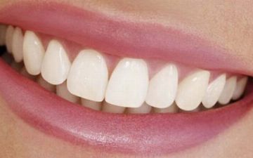 Какие продукты окрашивают зубы? 