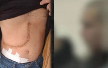 В Ташкенте вынесли приговор лицам, торговавшим человеческими органами и тканями