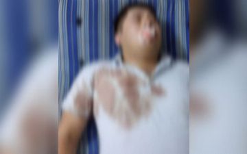 Житель Самаркандской области избил дежурного врача и фельдшера