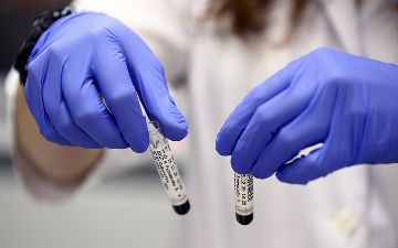 Ученый из России назвал российский штамм коронавируса «вежливым»