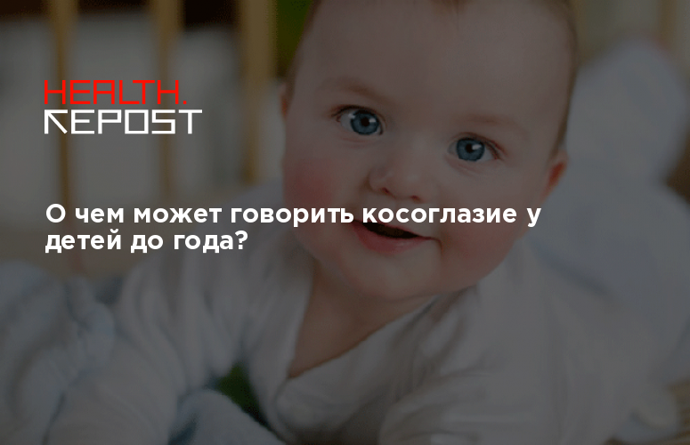 Косоглазие у детей до года