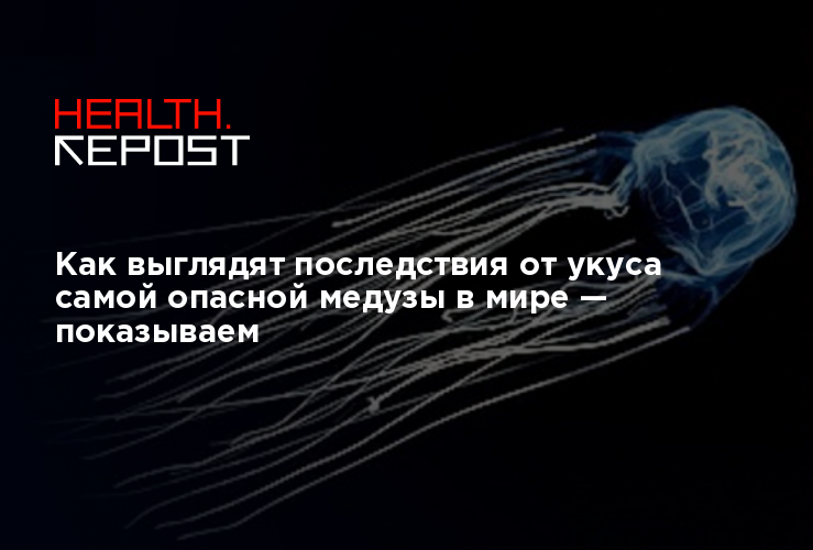 Как выглядят самые опасные медузы Как выглядят последствия от укуса самой опасной медузы в мире - показываем